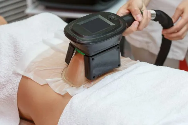 Image of person having fat freezing treatment to help weight gain Anniesland